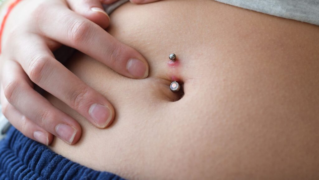 why is the skin around my belly button piercing dark